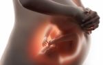 варикозное расширение вен во время беременности.